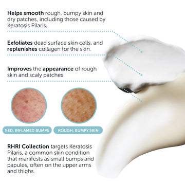 Keratosis Pilaris Bump Eraser Body Scrub + Lotion Set